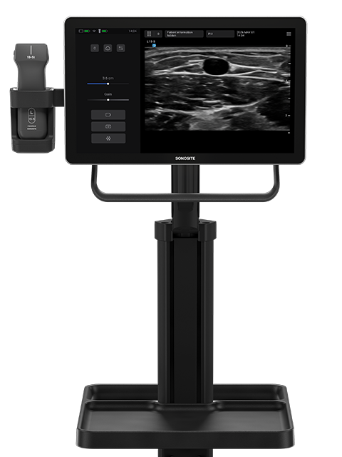 Sonosite iLOOK: сосудистому доступу предлагают собственное рабочее место