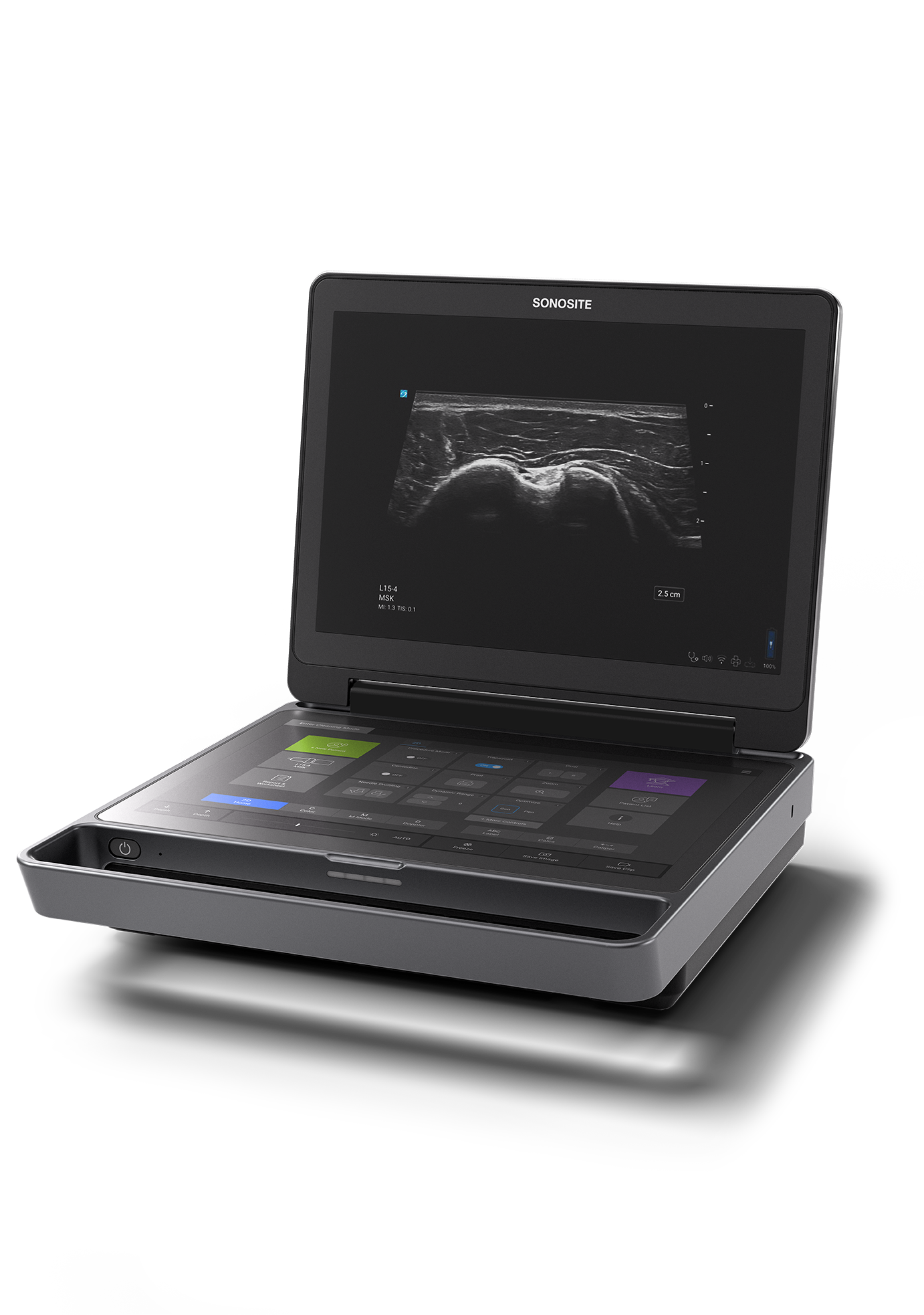 Sonosite MT: складной аппарат, который можно снять со стойки