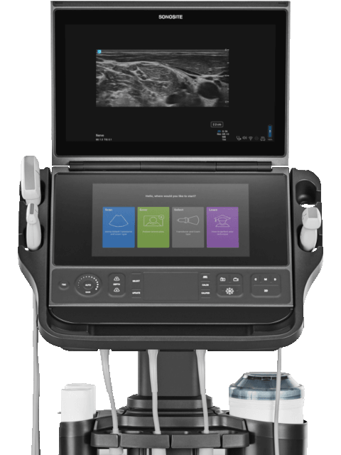 PIV Assist: Sonosite добавляет подсказки при планировании венозного доступа