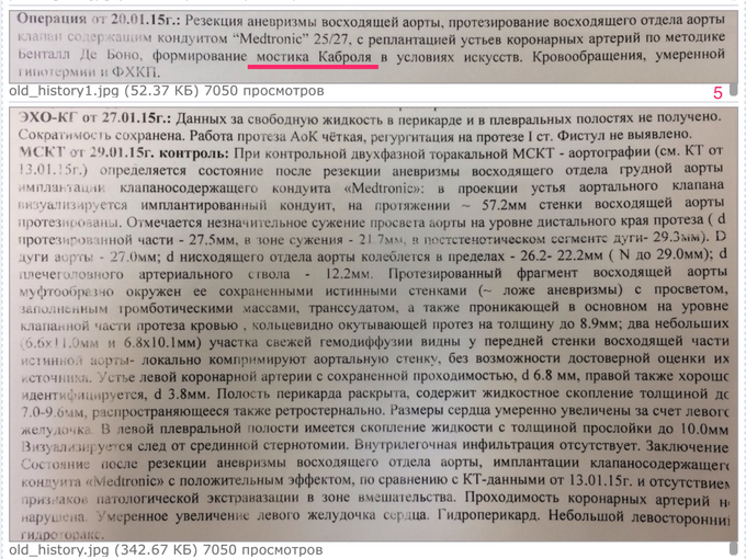 чпэхокг что это и для чего нужно. Смотреть фото чпэхокг что это и для чего нужно. Смотреть картинку чпэхокг что это и для чего нужно. Картинка про чпэхокг что это и для чего нужно. Фото чпэхокг что это и для чего нужно