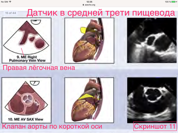 чпэхокг что это и для чего нужно. Смотреть фото чпэхокг что это и для чего нужно. Смотреть картинку чпэхокг что это и для чего нужно. Картинка про чпэхокг что это и для чего нужно. Фото чпэхокг что это и для чего нужно