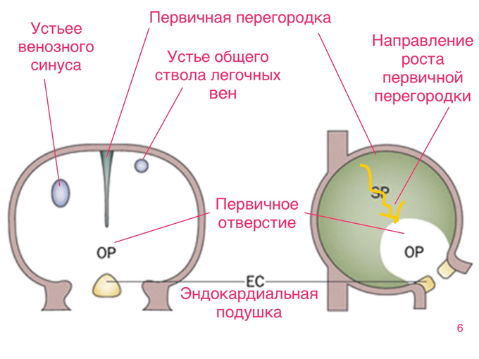 Межпредсердная перегородка истончена что это значит. Смотреть фото Межпредсердная перегородка истончена что это значит. Смотреть картинку Межпредсердная перегородка истончена что это значит. Картинка про Межпредсердная перегородка истончена что это значит. Фото Межпредсердная перегородка истончена что это значит