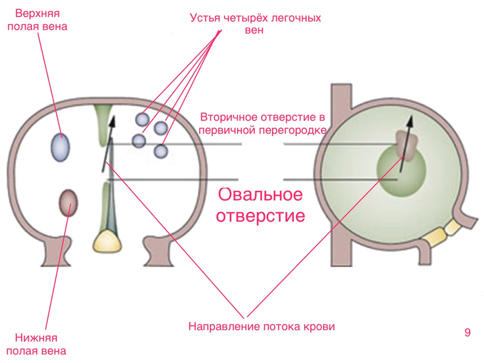 Межпредсердная перегородка истончена что это значит. Смотреть фото Межпредсердная перегородка истончена что это значит. Смотреть картинку Межпредсердная перегородка истончена что это значит. Картинка про Межпредсердная перегородка истончена что это значит. Фото Межпредсердная перегородка истончена что это значит