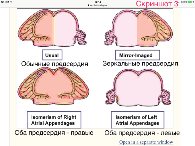 Situs solitus что это. IMG 1033. Situs solitus что это фото. Situs solitus что это-IMG 1033. картинка Situs solitus что это. картинка IMG 1033