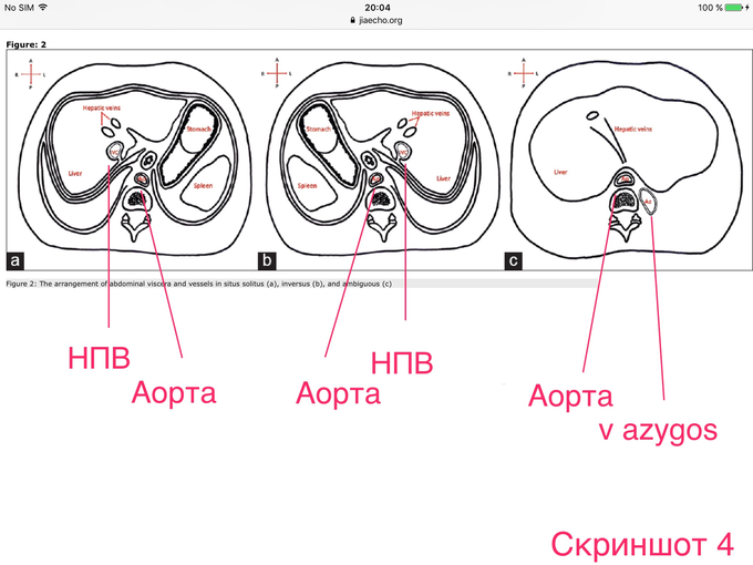 Situs solitus что это. IMG 1034. Situs solitus что это фото. Situs solitus что это-IMG 1034. картинка Situs solitus что это. картинка IMG 1034