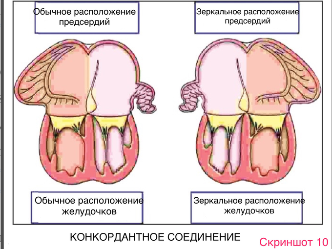 Situs solitus что это. IMG 1045. Situs solitus что это фото. Situs solitus что это-IMG 1045. картинка Situs solitus что это. картинка IMG 1045