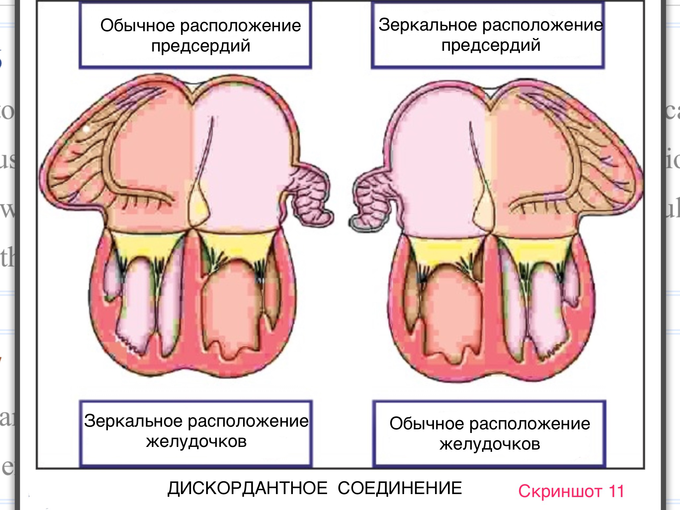 Situs solitus что это. IMG 1046. Situs solitus что это фото. Situs solitus что это-IMG 1046. картинка Situs solitus что это. картинка IMG 1046